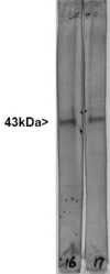 GAP43 Antibody - Western blot of whole rat spinal cord lysates probed with GAP43 antibody antibody to GAP43 in lane 16 and another similar antibody in lane 17. Dots in middle of strips indicate position of 50kDa and 37kDa protein bands. Note that the strong single band running at about 43kDa corresponds to GAP43.