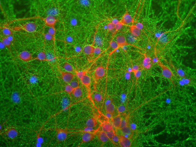 GAP43 Antibody - Mixed neuronal cultures stained with GAP43 antibody (green), RPCA-MAP2, a rabbit antibody to microtubule associated protein 2 (MAP2, red) and DNA (blue). The GAP43 antibody stains the plasma membrane of neurons and is particularly concentrated in dendrites.