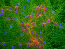 GAP43 Antibody - Mixed neuronal cultures stained with GAP43 antibody (green), RPCA-MAP2, a rabbit antibody to microtubule associated protein 2 (MAP2, red) and DNA (blue). The GAP43 antibody stains the plasma membrane of neurons and is particularly concentrated in dendrites.