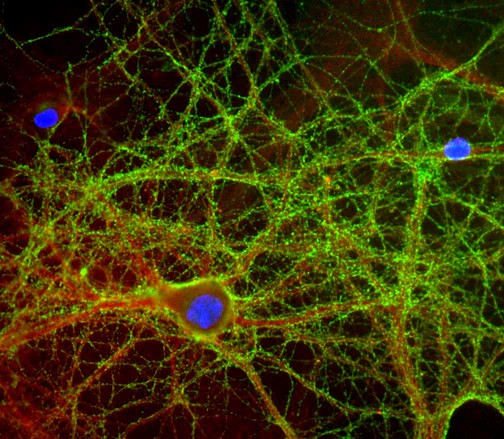 GAP43 Antibody - Mixed neuron-glial cultures stained with GAP43 antibody (green) and rabbit antibody to alpha-II spectrin (red), and DNA (blue). The GAP43 antibody stains numerous axonal and dendritic profiles in these cultures, clearly revealing the submembranous cytoskeleton and vesicles.