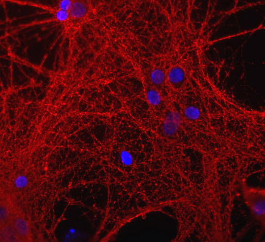 GAP43 Antibody - Mixed neuron-glial cultures stained with GAP43 antibody (red), blue is DNA staining.