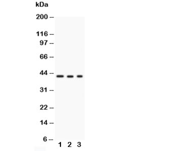 GAP43 Antibody - Western blot testing of GAP43 antibody and Lane 1: U87; 2: rat brain; 3: mouse brain; Predicted size: 43KD; Observed size: 43KD