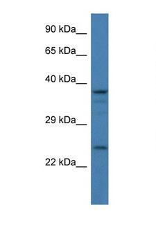 GAP43 Antibody - GAP43 antibody Western blot of 293T Cell lysate. Antibody concentration 1 ug/ml.  This image was taken for the unconjugated form of this product. Other forms have not been tested.