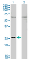 GAP43 Antibody - Western Blot analysis of GAP43 expression in transfected 293T cell line by GAP43 monoclonal antibody (M01), clone 3C11.Lane 1: GAP43 transfected lysate(24.8 KDa).Lane 2: Non-transfected lysate.