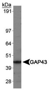 GAP43 Antibody - Western Blot: GAP43 Antibody - Analysis of GAP43 in human brain protein