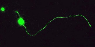 GAP43 Antibody - Immunocytochemistry/Immunofluorescence: GAP43 Antibody - Staining of a mature retinal ganglion cell demonstrating axon outgrowth.