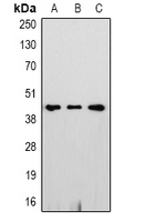 GAP43 Antibody - Western blot analysis of GAP43 expression in HeLa (A); mouse brain (B); rat brain (C) whole cell lysates.