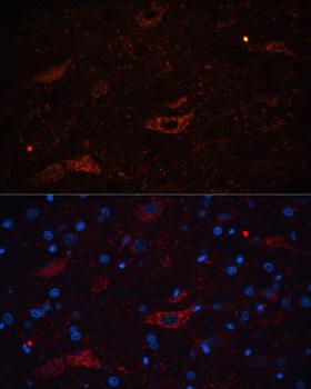 GAP43 Antibody - Immunofluorescence analysis of Rat brain using GAP43 Polyclonal Antibody at dilution of 1:100.Blue: DAPI for nuclear staining.