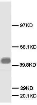 GAP43 Antibody -  This image was taken for the unconjugated form of this product. Other forms have not been tested.