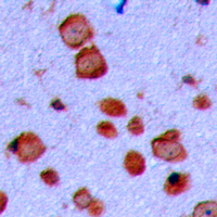 GAP43 Antibody - Immunohistochemical analysis of GAP43 staining in human brain formalin fixed paraffin embedded tissue section. The section was pre-treated using heat mediated antigen retrieval with sodium citrate buffer (pH 6.0). The section was then incubated with the antibody at room temperature and detected using an HRP conjugated compact polymer system. DAB was used as the chromogen. The section was then counterstained with hematoxylin and mounted with DPX.