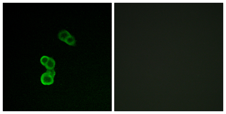 GAP43 Antibody - Immunofluorescence analysis of MCF-7 cells, using GAP43 (Phospho-Ser41) Antibody. The picture on the right is blocked with the phospho peptide.