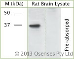 GAP43 Antibody - Rabbit antibody to phospho S41 GAP 43. WB on rat brain lysate using Rabbit antibody to phospho S41 GAP 43at 50 ug/ml concentration incubated overnight at 4?C. Pre-absorption of the antibody with the immunizing peptide completely abolishes the detected band.