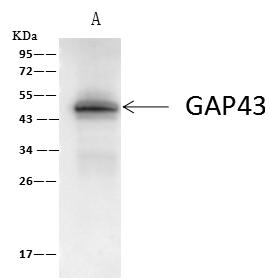 GAP43 Antibody - GAP43 was immunoprecipitated using: Lane A: 0.5 mg SH-SY5Y Whole Cell Lysate. 4 uL anti-GAP43 rabbit polyclonal antibody and 60 ug of Immunomagnetic beads Protein A/G. Primary antibody: Anti-GAP43 rabbit polyclonal antibody, at 1:100 dilution. Secondary antibody: Clean-Blot IP Detection Reagent (HRP) at 1:1000 dilution. Developed using the ECL technique. Performed under reducing conditions. Predicted band size: 45 kDa. Observed band size: 47 kDa.