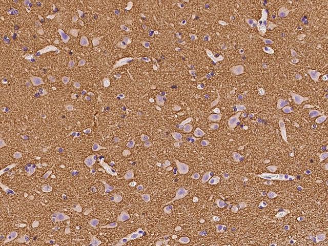 GAP43 Antibody - Immunochemical staining of human GAP43 in human brain with rabbit polyclonal antibody at 1:300 dilution, formalin-fixed paraffin embedded sections.