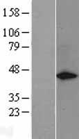 GAP43 Protein - Western validation with an anti-DDK antibody * L: Control HEK293 lysate R: Over-expression lysate