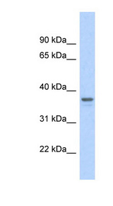 GAPDH Antibody - GAPDH antibody Western blot of Fetal Heart lysate. This image was taken for the unconjugated form of this product. Other forms have not been tested.