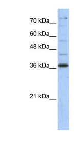 GAPDH Antibody - GAPDH antibody Western blot of Transfected 293T cell lysate.  This image was taken for the unconjugated form of this product. Other forms have not been tested.