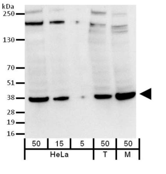 GAPDH Antibody - Detection of Human GAPDH by Western Blot. Samples: Whole Cell Lysate from HeLa cells (50, 15 and 5 ug) 293T (T; 50 ug) and NIH3T3 (M; 50 ug). Antibodies: Purified mouse monoclonal anti-GAPDH antibody was used at 0.04 ug/ml. Detection: Chemiluminescence with an exposure time of 3 seconds.