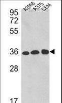 GAPDH Antibody - Western blot of GAPDH Antibody (C-term R248) in A2058, A375, CEM cell line lysates (35 ug/lane). GAPDH (arrow) was detected using the purified antibody.