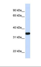 GAPDH Antibody - Fetal brain lysate. Antibody concentration: 1.0 ug/ml. Gel concentration: 12%.  This image was taken for the unconjugated form of this product. Other forms have not been tested.