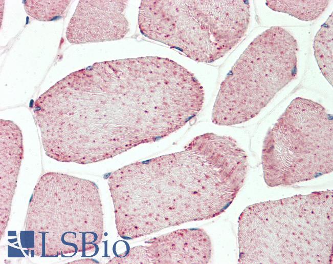 GAPDH Antibody - Anti-GAPDH antibody IHC staining of human skeletal muscle. Immunohistochemistry of formalin-fixed, paraffin-embedded tissue after heat-induced antigen retrieval. Antibody concentration 10 ug/ml.  This image was taken for the unconjugated form of this product. Other forms have not been tested.