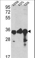 GAPDH Antibody - Western blot of GAPDH Antibody in A2058, A375, CEM cell line lysates (35 ug/lane). GAPDH (arrow) was detected using the purified antibody.