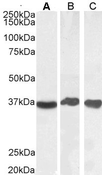 GAPDH Antibody - GAPDH antibody (0.1µg/ml) staining of Human Liver (A), (0.03ug/ml) Testes (B) and Tonsil (C) lysate (35µg protein in RIPA buffer). Detected by chemiluminescence.