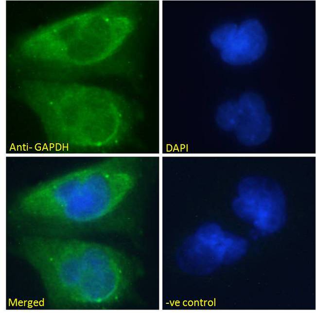 GAPDH Antibody - GAPDH (Internal) Antibody Immunofluorescence analysis of paraformaldehyde fixed U251 cells, permeabilized with 0.15% Triton. Primary incubation 1hr (10ug/ml) followed by Alexa Fluor 488 secondary antibody (2ug/ml), showing cytoplasmic and vesicle staining. The nuclear stain is DAPI (blue). Negative control: Unimmunized goat IgG (10ug/ml) followed by Alexa Fluor 488 secondary antibody (2ug/ml).