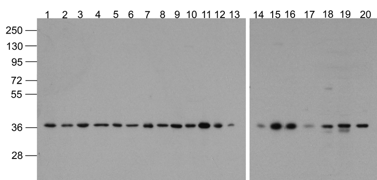 GAPDH Antibody - Western blot analysis of GAPDH in 293, A431, A549, Daudi, HeLa, HepG2, Jurkat, K562, MOLT4, 3T3, Raji, Ramos, U937, human brain, mouse brain, rat brain, mouse lung, mouse liver, rat liver, and chicken small intestine lysate with Biotin-GAPDH antibody at 1 ug/mL.