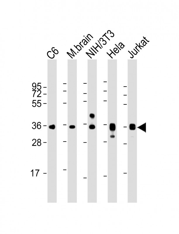 GAPDH Antibody - All lanes: Anti-GAPDH Antibody at 1:8000 dilution Lane 1: C6 whole cell lysate Lane 2: mouse brain lysate Lane 3: NIH/3T3 whole cell lysate Lane 4: Hela whole cell lysate Lane 5: Jurkat whole cell lysate Lysates/proteins at 20 µg per lane. Secondary Goat Anti-mouse IgG, (H+L), Peroxidase conjugated at 1/10000 dilution. Predicted band size: 36 kDa Blocking/Dilution buffer: 5% NFDM/TBST.