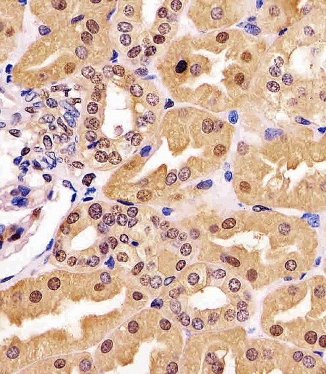 GAPDH Antibody - GAPDH Antibody staining GAPDH in human kidney tissue sections by Immunohistochemistry (IHC-P - paraformaldehyde-fixed, paraffin-embedded sections). Tissue was fixed with formaldehyde and blocked with 3% BSA for 0. 5 hour at room temperature; antigen retrieval was by heat mediation with a citrate buffer (pH6). Samples were incubated with primary antibody (1/25) for 1 hours at 37°C. A undiluted biotinylated goat polyvalent antibody was used as the secondary antibody.