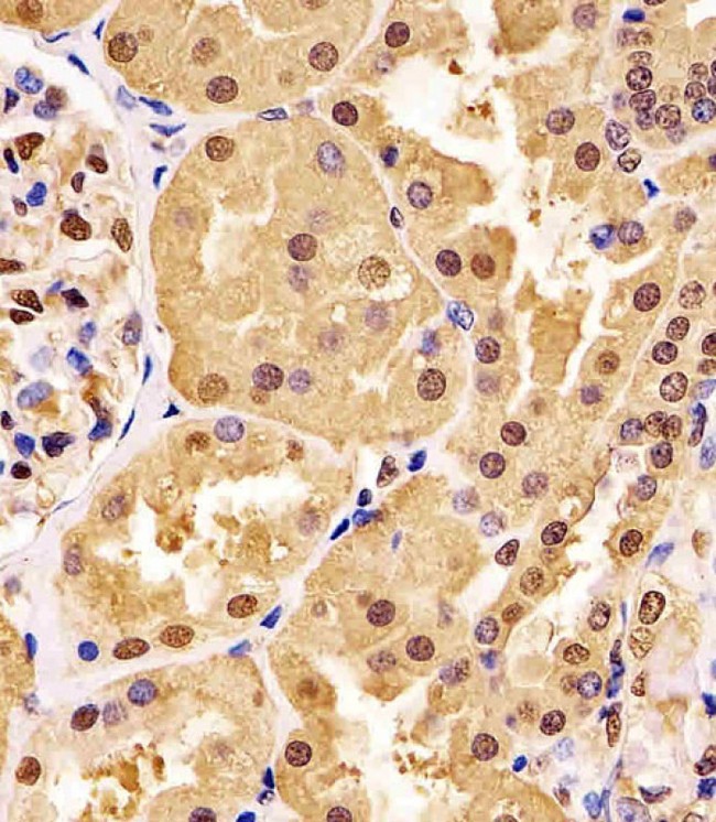 GAPDH Antibody - GAPDH Antibody staining GAPDH in human kidney tissue sections by Immunohistochemistry (IHC-P - paraformaldehyde-fixed, paraffin-embedded sections). Tissue was fixed with formaldehyde and blocked with 3% BSA for 0. 5 hour at room temperature; antigen retrieval was by heat mediation with a citrate buffer (pH6). Samples were incubated with primary antibody (1/25) for 1 hours at 37°C. A undiluted biotinylated goat polyvalent antibody was used as the secondary antibody.