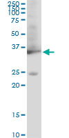 GAPDH Antibody - GAPDH monoclonal antibody (M01), clone 3C2. Western Blot analysis of GAPDH expression in PC-12.