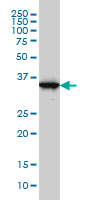 GAPDH Antibody - GAPDH monoclonal antibody (M01), clone 3C2 Western Blot analysis of GAPDH expression in A-431.