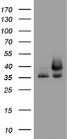 GAPDH Antibody - HEK293T cells were transfected with the pCMV6-ENTRY control (Left lane) or pCMV6-ENTRY GAPDH (Right lane) cDNA for 48 hrs and lysed. Equivalent amounts of cell lysates (5 ug per lane) were separated by SDS-PAGE and immunoblotted with anti-GAPDH.