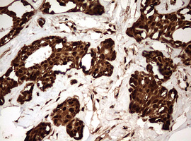 GAPDH Antibody - IHC of paraffin-embedded Human breast tissue using anti-GAPDH mouse monoclonal antibody. (Heat-induced epitope retrieval by 10mM citric buffer, pH6.0, 120°C for 3min).