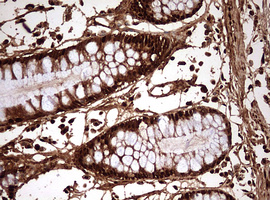 GAPDH Antibody - IHC of paraffin-embedded Human colon tissue using anti-GAPDH mouse monoclonal antibody. (Heat-induced epitope retrieval by 10mM citric buffer, pH6.0, 120°C for 3min).