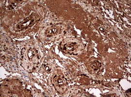 GAPDH Antibody - IHC of paraffin-embedded Human Ovary tissue using anti-GAPDH mouse monoclonal antibody. (Heat-induced epitope retrieval by 10mM citric buffer, pH6.0, 120°C for 3min).