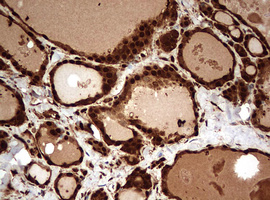 GAPDH Antibody - IHC of paraffin-embedded Human thyroid tissue using anti-GAPDH mouse monoclonal antibody. (Heat-induced epitope retrieval by 10mM citric buffer, pH6.0, 120°C for 3min).