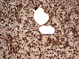 GAPDH Antibody - IHC of paraffin-embedded Human pancreas tissue using anti-GAPDH mouse monoclonal antibody. (Heat-induced epitope retrieval by 10mM citric buffer, pH6.0, 120°C for 3min).