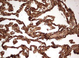 GAPDH Antibody - IHC of paraffin-embedded Human lung tissue using anti-GAPDH mouse monoclonal antibody. (Heat-induced epitope retrieval by 10mM citric buffer, pH6.0, 120°C for 3min).