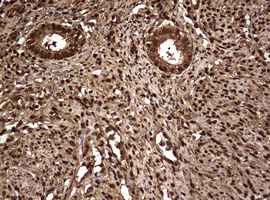 GAPDH Antibody - IHC of paraffin-embedded Human endometrium tissue using anti-GAPDH mouse monoclonal antibody. (Heat-induced epitope retrieval by 10mM citric buffer, pH6.0, 120°C for 3min).