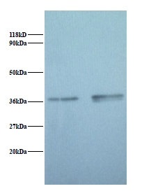 GAPDH Antibody - Western blot of Glyceraldehyde-3-phosphate dehydrogenase antibody at 2 ug/ml. Lane 1: EC109 whole cell lysate. Lane 2: 293T whole cell lysate. Secondary: Goat polyclonal to Rabbit IgG at 1:15000 dilution. Predicted band size: 37 kDa. Observed band size: 37 kDa.  This image was taken for the unconjugated form of this product. Other forms have not been tested.