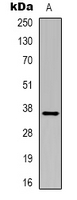 GAPDH Antibody - Western blot analysis of GAPDH-HRP labeled expression in HeLa (A) whole cell lysates. This image was taken for the unconjugated form of this product. Other forms have not been tested.