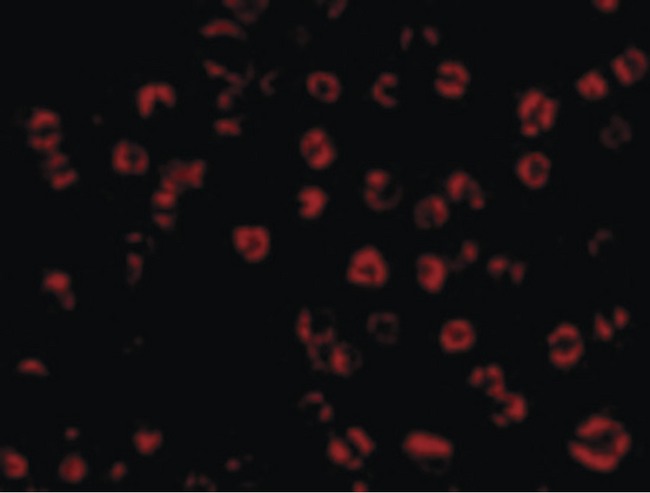 GAPDH Antibody - Immunofluorescence of GAPDH in HeLa cells with GAPDH antibody at 10 ug/ml.
