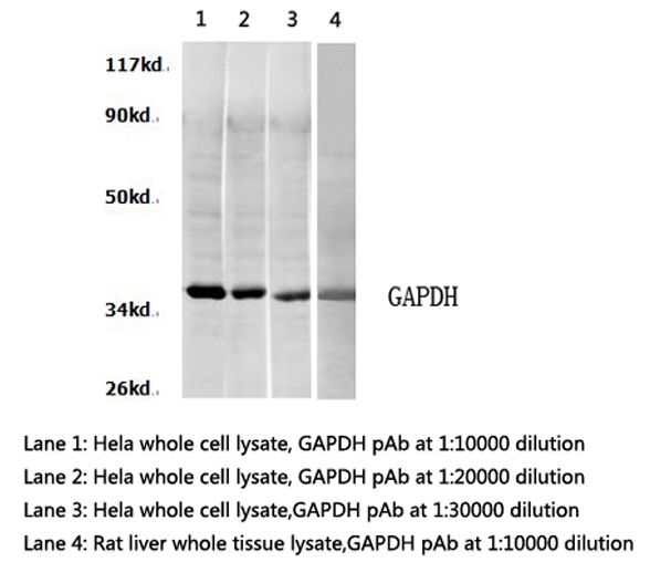 GAPDH Antibody - Western blot of GAPDH pAb in extracts from HeLa cells and rat liver tissue.
