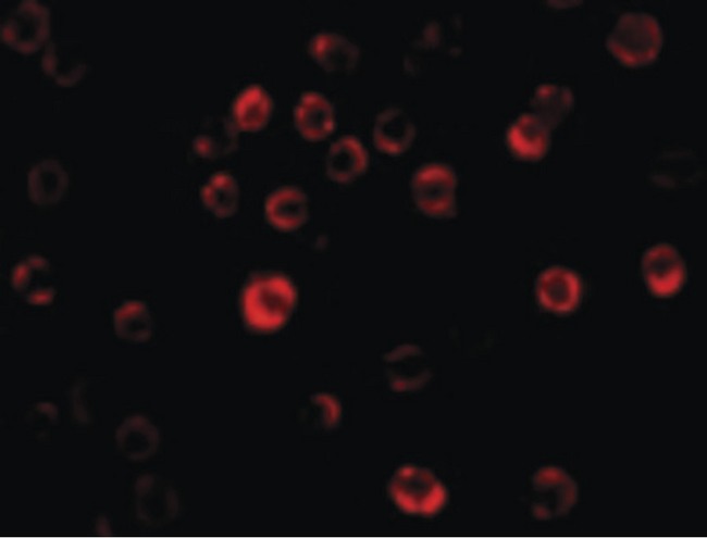 GAPDH Antibody - Immunofluorescence of GAPDH in HeLa cells with GAPDH antibody at 20 ug/ml.