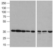 GAPDH Antibody - Western blot analysis of GAPDH in A431, Daudi, HepG2, HL60, Jurkat, Human kidney, Mouse lung, and Chicken liver lysate with GAPDH antibody 0.5ug/ml.