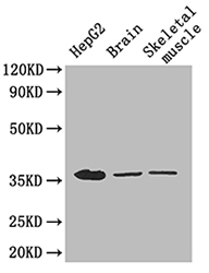 GAPDH Antibody - Western blot using Glyceraldehyde-3-phosphate dehydrogenase antibody at 2.6 ug/ml. Lane 1: HepG2 whole cell lysate, Lane 2: Mouse brain lysate, Lane 3: Mouse skeletal muscle lysate