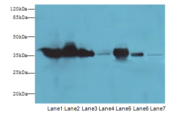 GAPDH Antibody - Western blot using GADPH antibody at 2 ug/ml.  Lane 1, HeLa cell lysate; Lane 2, 293T cell lysate; Lane 3, Jurkat cell lysates; Lane 4, Mouse kidney extract; Lane 5, Rat muscle extract; Lane 6, Rat lung extract; and Lane 7, Zebrafish extract.